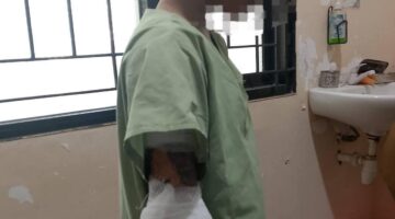 Tragis! Remaja di Tambak Lorok Diduga Dibakar Kerabat, Polisi Sigap Beri Pendampingan